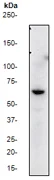 Western blot - Anti-AKT3 + AKT2 + AKT1 antibody [Y89] (AB32505)