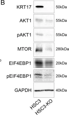 Western blot - Anti-AKT3 + AKT2 + AKT1 antibody [Y89] - BSA and Azide free (AB219588)