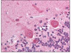 Immunohistochemistry (Formalin/PFA-fixed paraffin-embedded sections) - Anti-AKT3 antibody [66C1247.1] (AB118509)