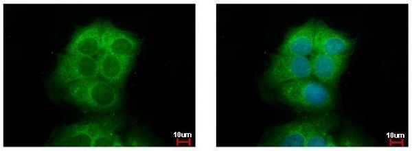 Immunocytochemistry/ Immunofluorescence - Anti-AKT3 antibody (AB152157), expandable thumbnail