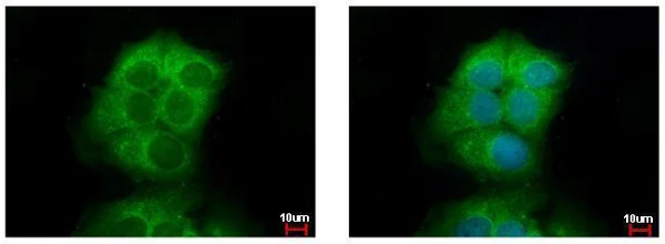 Immunocytochemistry/ Immunofluorescence - Anti-AKT3 antibody (AB152157)