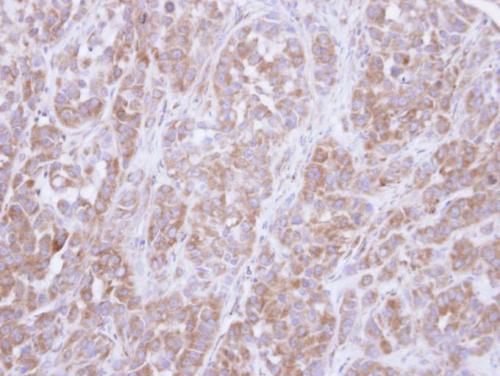 Immunohistochemistry (Formalin/PFA-fixed paraffin-embedded sections) - Anti-AKT3 antibody (AB152157), expandable thumbnail