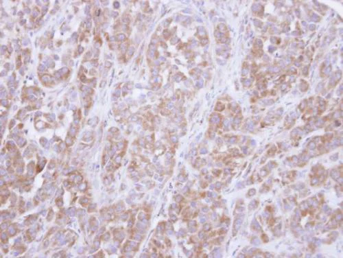 Immunohistochemistry (Formalin/PFA-fixed paraffin-embedded sections) - Anti-AKT3 antibody (AB152157)