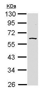 Western blot - Anti-AKT3 antibody (AB152157), expandable thumbnail