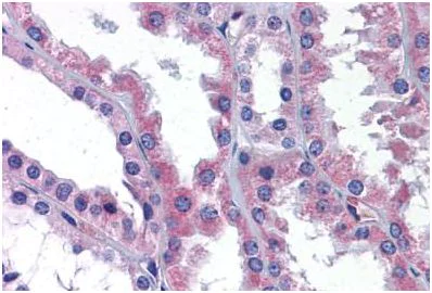 Immunohistochemistry (Formalin/PFA-fixed paraffin-embedded sections) - Anti-AKT3 antibody (AB189643)