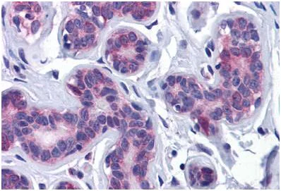 Immunohistochemistry (Formalin/PFA-fixed paraffin-embedded sections) - Anti-AKT3 antibody (AB189643)