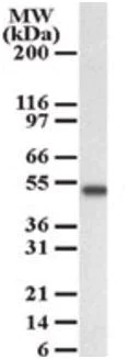 Western blot - Anti-AKT3 antibody (AB189643)