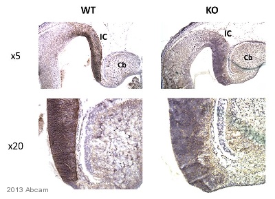 Immunohistochemistry (Formalin/PFA-fixed paraffin-embedded sections) - Anti-AL-1 antibody (AB70114), expandable thumbnail