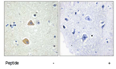Immunohistochemistry (Formalin/PFA-fixed paraffin-embedded sections) - Anti-AL-1 antibody (AB70114), expandable thumbnail