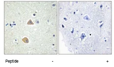 Immunohistochemistry (Formalin/PFA-fixed paraffin-embedded sections) - Anti-AL-1 antibody (AB70114)