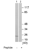Western blot - Anti-AL-1 antibody (AB70114), expandable thumbnail