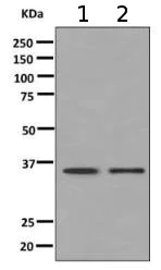 Western blot - Anti-ALAD antibody [EPR10268(B)] - BSA and Azide free (AB249066)