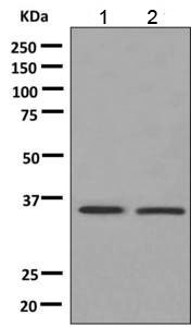 Western blot - Anti-ALAD antibody [EPR10269(B)] (AB151697)
