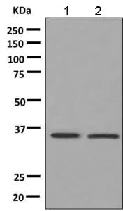 Western blot - Anti-ALAD antibody [EPR10269(B)] (AB151697)