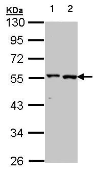 Western blot - Anti-Alanine Transaminase antibody (AB137531)