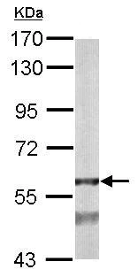 Western blot - Anti-Alanine Transaminase antibody (AB137531)