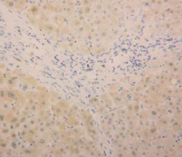Immunohistochemistry (Formalin/PFA-fixed paraffin-embedded sections) - Anti-Alanine Transaminase antibody (AB231629), expandable thumbnail