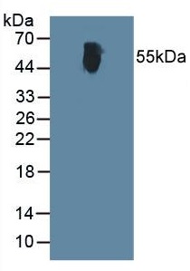 Western blot - Anti-Alanine Transaminase antibody (AB231629), expandable thumbnail