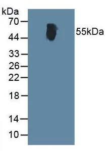 Western blot - Anti-Alanine Transaminase antibody (AB231629)