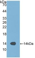 Western blot - Anti-Alanine Transaminase antibody (AB231629), expandable thumbnail