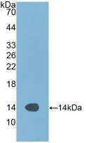 Western blot - Anti-Alanine Transaminase antibody (AB231629)