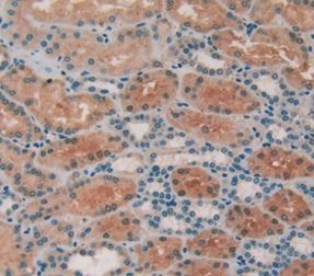 Immunohistochemistry (Formalin/PFA-fixed paraffin-embedded sections) - Anti-Alanine Transaminase antibody (AB231715), expandable thumbnail
