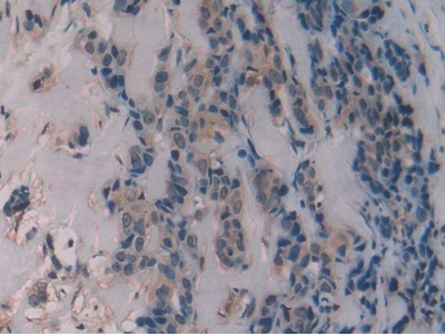 Immunohistochemistry (Formalin/PFA-fixed paraffin-embedded sections) - Anti-Alanine Transaminase antibody (ab231715), expandable thumbnail