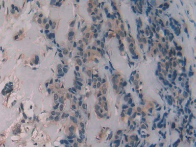 Immunohistochemistry (Formalin/PFA-fixed paraffin-embedded sections) - Anti-Alanine Transaminase antibody (AB231715)