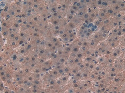 Immunohistochemistry (Formalin/PFA-fixed paraffin-embedded sections) - Anti-Alanine Transaminase antibody (AB231715), expandable thumbnail