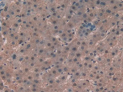 Immunohistochemistry (Formalin/PFA-fixed paraffin-embedded sections) - Anti-Alanine Transaminase antibody (AB231715)