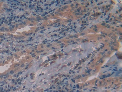Immunohistochemistry (Formalin/PFA-fixed paraffin-embedded sections) - Anti-Alanine Transaminase antibody (ab231715), expandable thumbnail