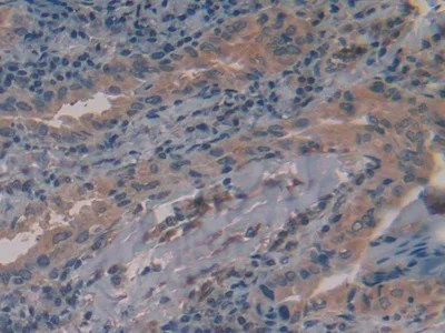 Immunohistochemistry (Formalin/PFA-fixed paraffin-embedded sections) - Anti-Alanine Transaminase antibody (AB231715)
