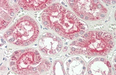 Immunohistochemistry (Formalin/PFA-fixed paraffin-embedded sections) - Anti-Alanine Transaminase antibody (ab231715), expandable thumbnail