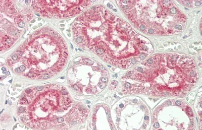 Immunohistochemistry (Formalin/PFA-fixed paraffin-embedded sections) - Anti-Alanine Transaminase antibody (AB231715)