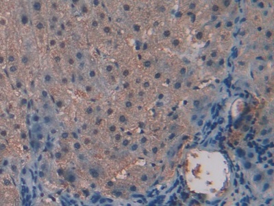 Immunohistochemistry (Formalin/PFA-fixed paraffin-embedded sections) - Anti-Alanine Transaminase antibody (AB231715), expandable thumbnail