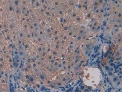 Immunohistochemistry (Formalin/PFA-fixed paraffin-embedded sections) - Anti-Alanine Transaminase antibody (AB231715)