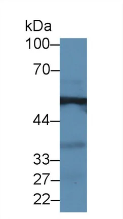 Western blot - Anti-Alanine Transaminase antibody (AB231715)