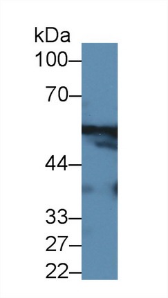 Western blot - Anti-Alanine Transaminase antibody (AB231715), expandable thumbnail