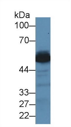 Western blot - Anti-Alanine Transaminase antibody (ab231715), expandable thumbnail