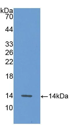 Western blot - Anti-Alanine Transaminase antibody (AB231715)