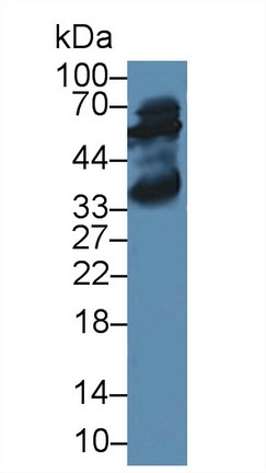 Western blot - Anti-Alanine Transaminase antibody (AB231715), expandable thumbnail