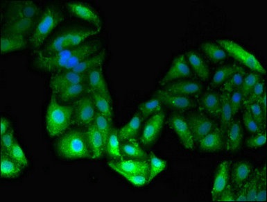 Immunocytochemistry/ Immunofluorescence - Anti-Alanine Transaminase antibody (AB236658), expandable thumbnail