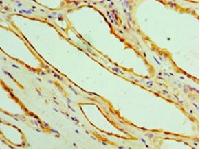 Immunohistochemistry (Formalin/PFA-fixed paraffin-embedded sections) - Anti-Alanine Transaminase antibody (AB236658), expandable thumbnail