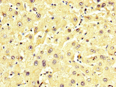 Immunohistochemistry (Formalin/PFA-fixed paraffin-embedded sections) - Anti-Alanine Transaminase antibody (AB236658), expandable thumbnail