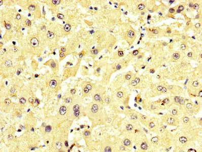 Immunohistochemistry (Formalin/PFA-fixed paraffin-embedded sections) - Anti-Alanine Transaminase antibody (AB236658)