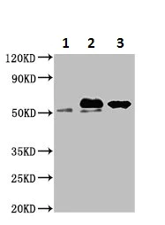 Immunoprecipitation - Anti-Alanine Transaminase antibody (AB236658)