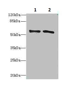 Western blot - Anti-Alanine Transaminase antibody (ab236658), expandable thumbnail