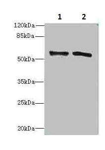 Western blot - Anti-Alanine Transaminase antibody (AB236658)
