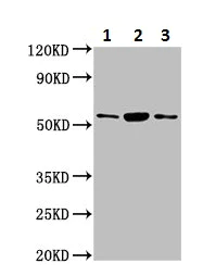 Western blot - Anti-Alanine Transaminase antibody (AB236658)