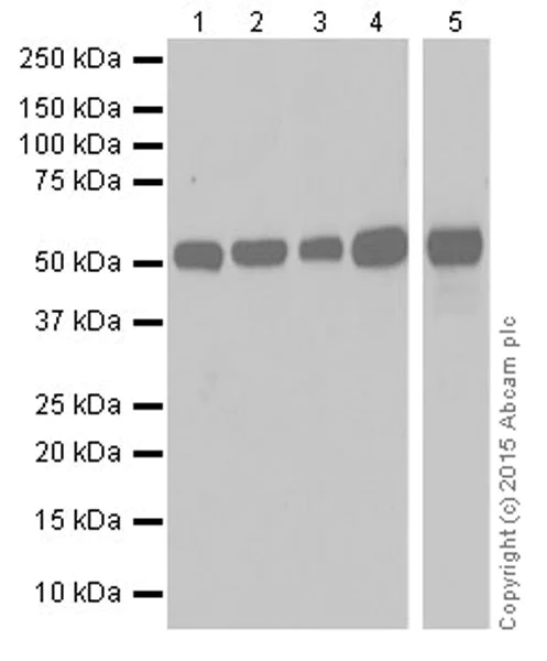 Western blot - Anti-Alanine Transaminase antibody [EPR19616] (AB202083)